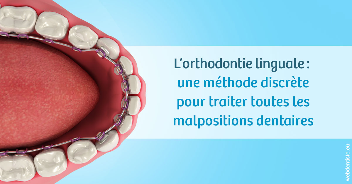 https://selarl-cabinet-dentaire-deberdt.chirurgiens-dentistes.fr/L'orthodontie linguale 1