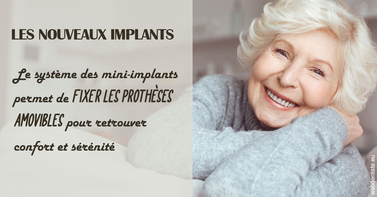 https://selarl-cabinet-dentaire-deberdt.chirurgiens-dentistes.fr/Les nouveaux implants 1