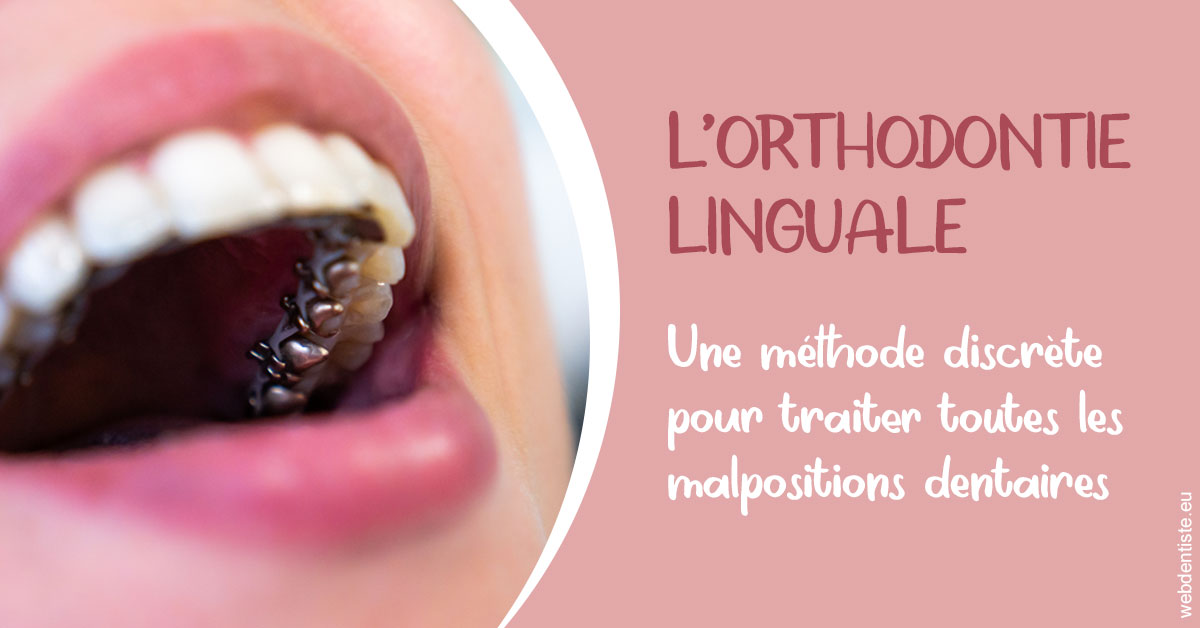 https://selarl-cabinet-dentaire-deberdt.chirurgiens-dentistes.fr/L'orthodontie linguale 2