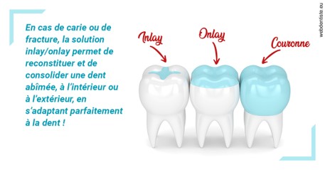 https://selarl-cabinet-dentaire-deberdt.chirurgiens-dentistes.fr/L'INLAY ou l'ONLAY
