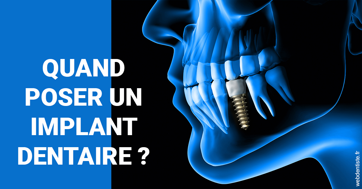 https://selarl-cabinet-dentaire-deberdt.chirurgiens-dentistes.fr/Les implants 1