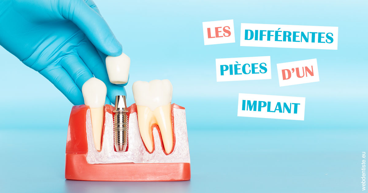 https://selarl-cabinet-dentaire-deberdt.chirurgiens-dentistes.fr/Les différentes pièces d’un implant 2