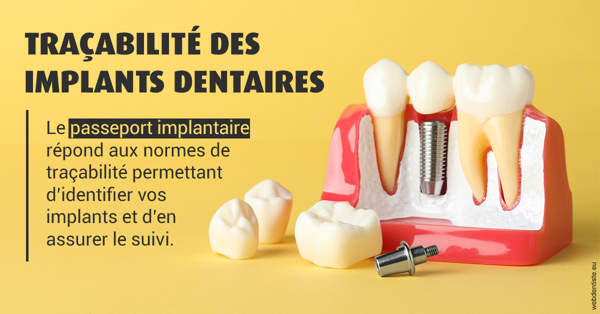 https://selarl-cabinet-dentaire-deberdt.chirurgiens-dentistes.fr/T2 2023 - Traçabilité des implants 2