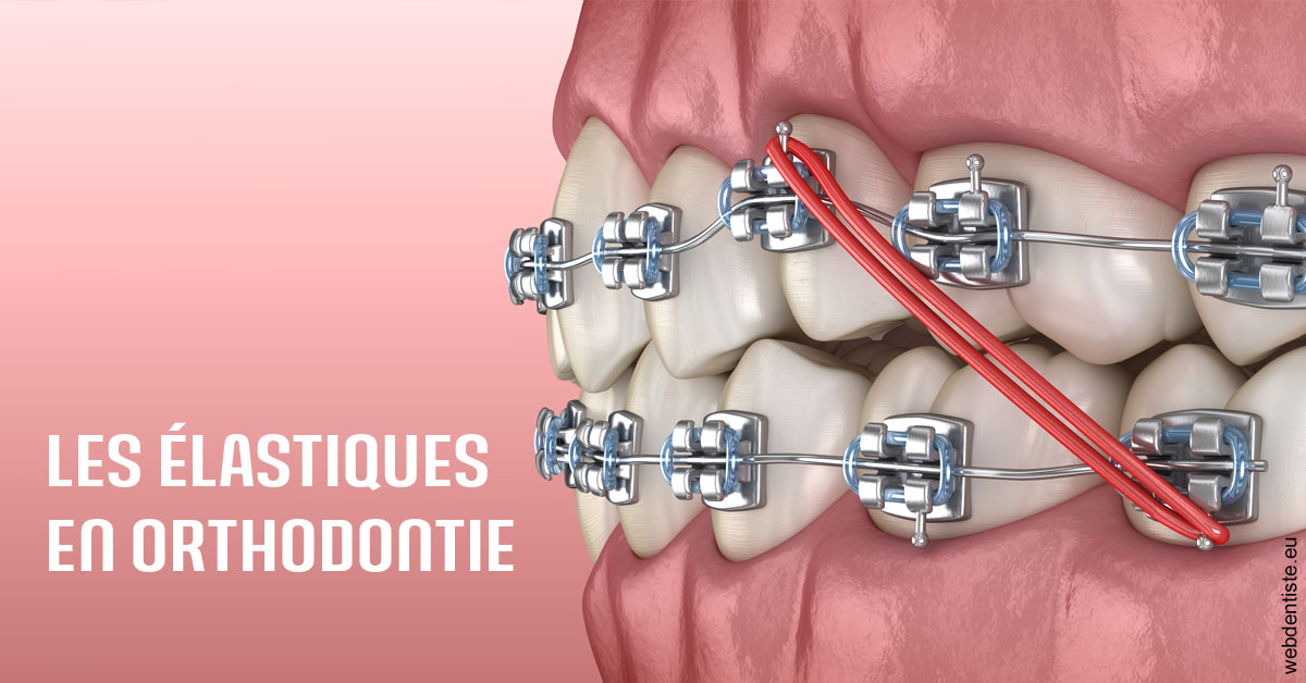 https://selarl-cabinet-dentaire-deberdt.chirurgiens-dentistes.fr/Elastiques orthodontie 2