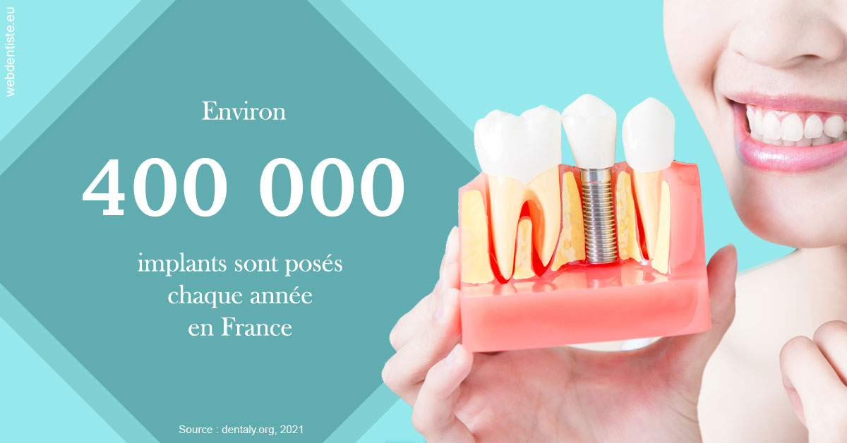 https://selarl-cabinet-dentaire-deberdt.chirurgiens-dentistes.fr/Pose d'implants en France 2